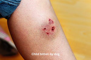 Personal Injury Claims for Children | What Parents Must Know